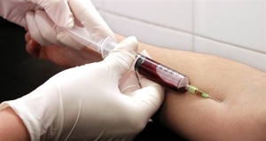 インフルエンザの血清抗体検査